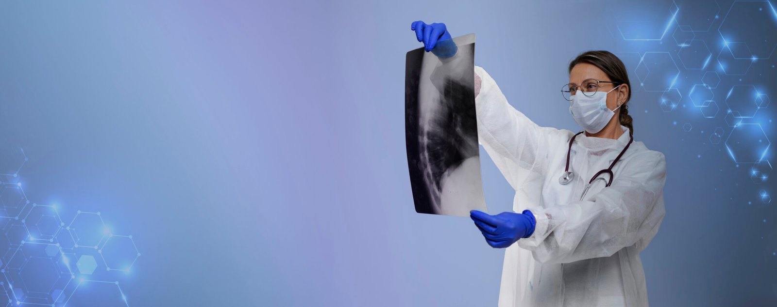 best xray center in bangalore