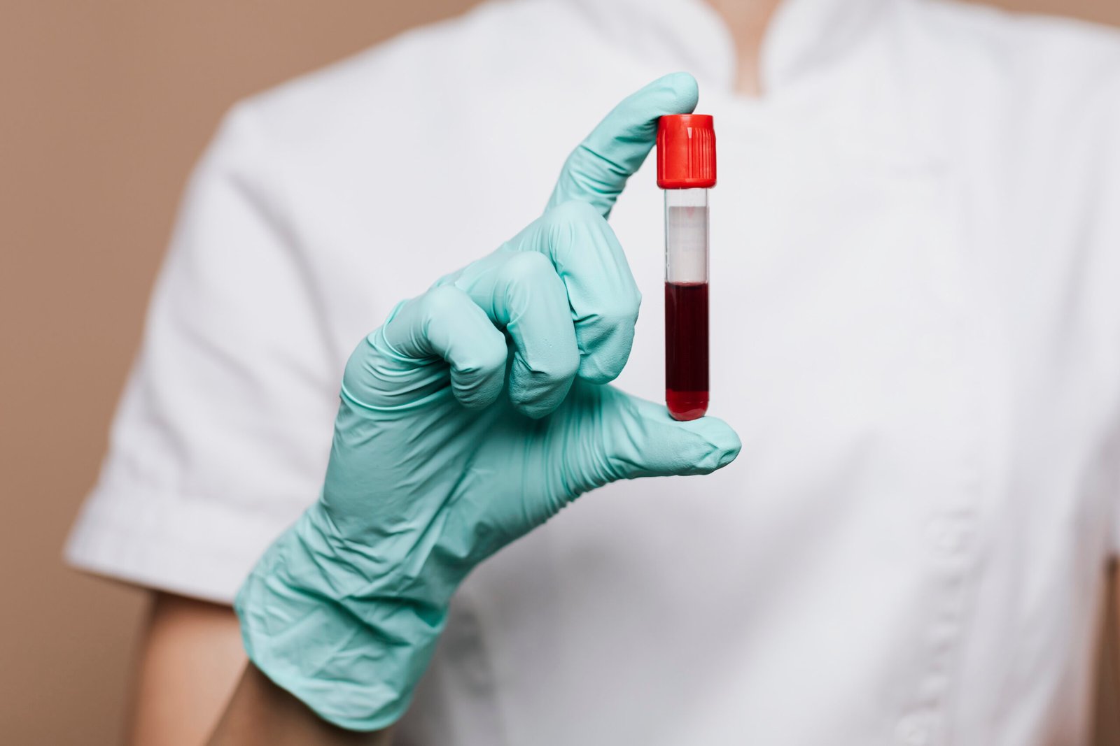 Blood Test in Bangalore